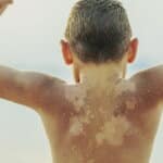 Cele mai frecvente boli la copii pe timpul verii. Sfatul medicilor