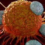 De ce se răspândeşte aşa rapid cancerul în tot corpul? Descoperire remarcabila făcută de medici