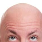 Fumatul provoaca aparitia calvitiei la barbati