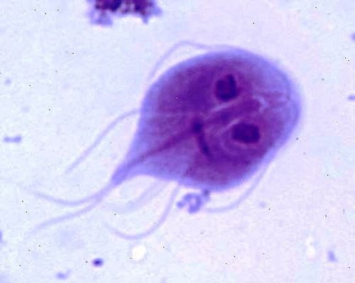 Parazitoze intestinale provocate de Giardia lamblia