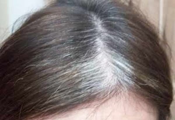 greyhair