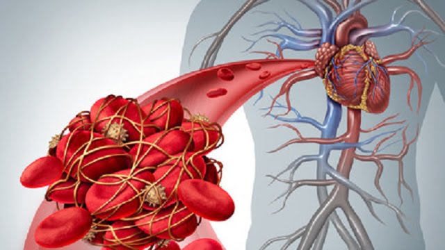 Regimurile alimentare in bolile cardio-vasculare si hipertensiunea arteriala