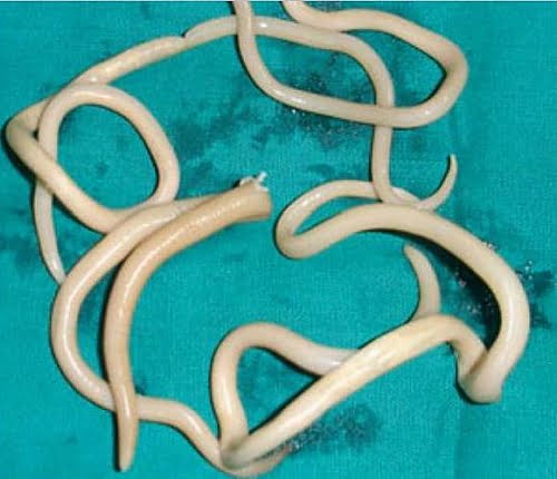 Parazitoze intestinale provocate de Ascaris lumbricoides (limbric)