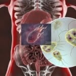 Cele mai intalnite parazitoze intestinale la copii si adulti