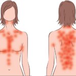 Deficienta de vitamina D: un semnal de alarma pentru sanatatea ta