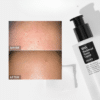 Soluție exfoliantă cu BHA pentru puncte negre, 100ml, COSRX Soluție exfoliantă cu BHA pentru puncte negre, 100ml, COSRX – imagine 3