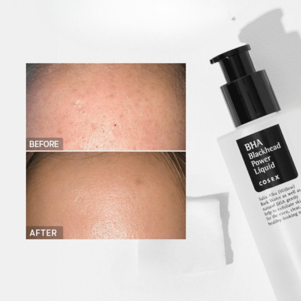 Soluție exfoliantă cu BHA pentru puncte negre, 100ml, COSRX Soluție exfoliantă cu BHA pentru puncte negre, 100ml, COSRX – imagine 3